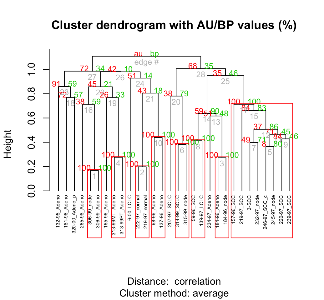 Clustering - Unsupervised Machine Learning